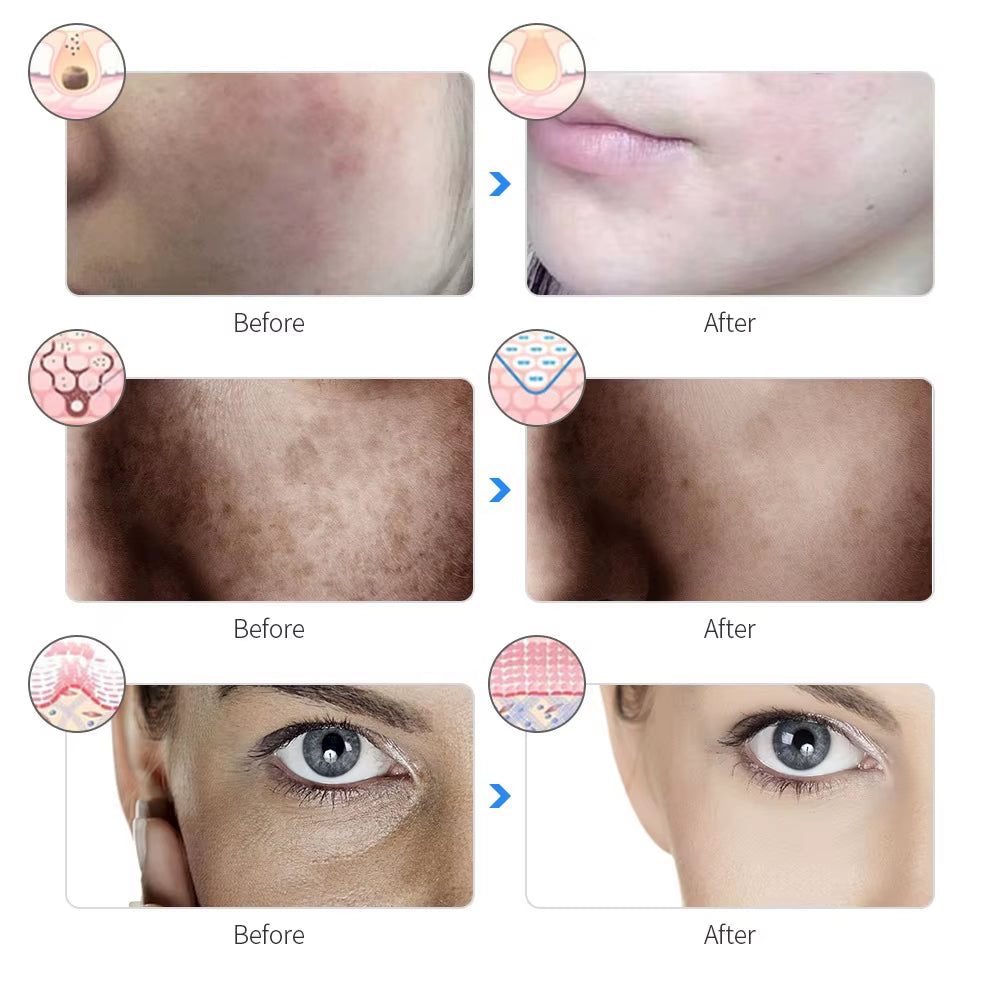 7 Color Wireless Light Therapy Mask Anti-Aging Acne Spot Scar Removal Smooth Wrinkles Facial Beauty Daily Skin Care Led Mask